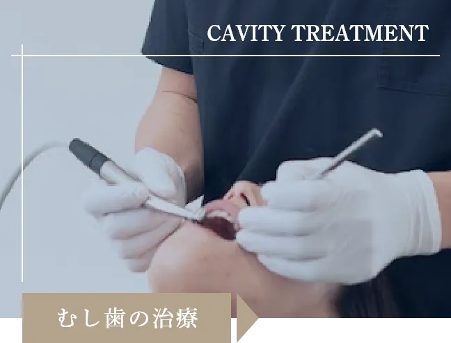 むし歯の治療
