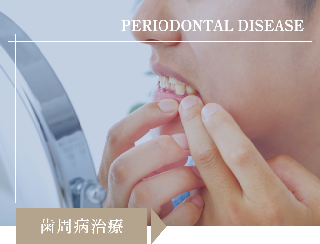 歯周病治療