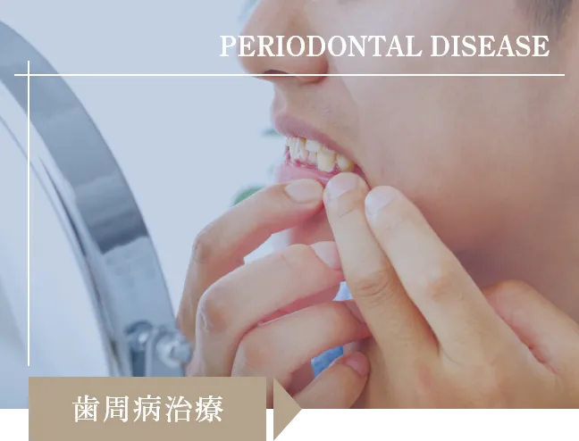 歯周病治療