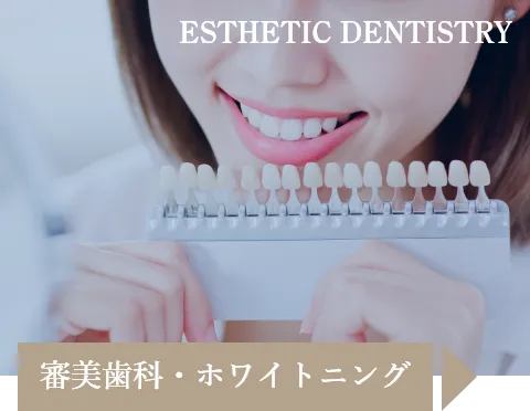 審美治療ホワイトニング