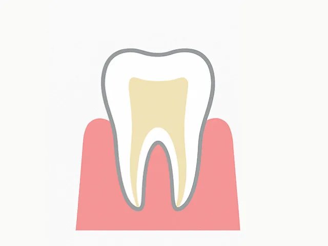 根管に蓋をする