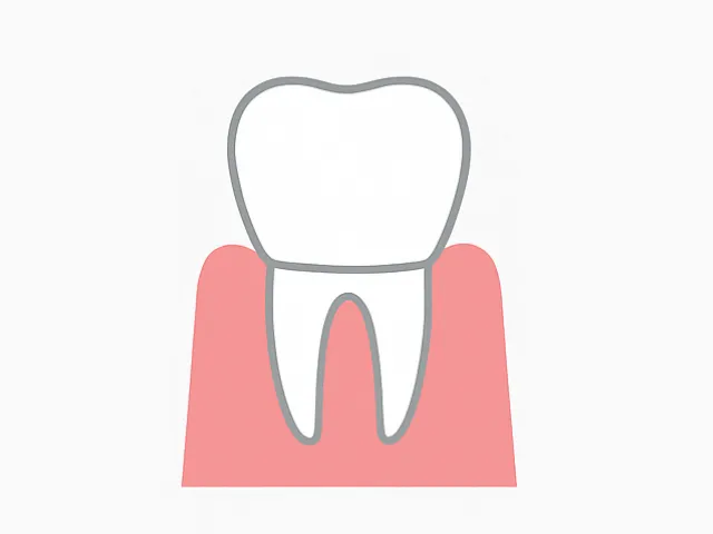 最後に被せ物を装着