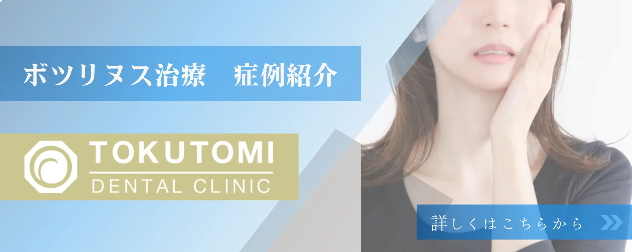 ボツリヌス治療症例紹介