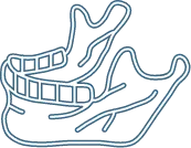 充分な骨の質と量があること